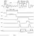 Fig. 06 - Switching power supply circuit with synchronous rectifier and associated control circuit and control method