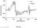 Fig. 07 - Label-Free Single and Multi-Photon Fluorescence Spectroscopy to Detect Brain Disorders and Diseases: Alzheimer, Parkinson, and Autism From Brain Tissue, Cells, Spinal Fluid, and Body Fluids