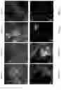 Fig. 08 - Label-Free Single and Multi-Photon Fluorescence Spectroscopy to Detect Brain Disorders and Diseases: Alzheimer, Parkinson, and Autism From Brain Tissue, Cells, Spinal Fluid, and Body Fluids