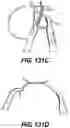 Fig. 136 - Medical systems comprising tool members