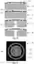 Fig. 08 - Micro check valve and system with multiple micro check valves and method for the production thereof