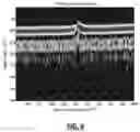 Fig. 07 - Neural network system for non-destructive optical coherence tomography