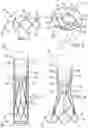 Fig. 02 - Retaining mechanisms for prosthetic valves