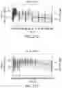 Fig. 33 - Compositions of obeticholic acid and methods of use