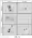 Fig. 12 - Methods for treating hepatitis B infection