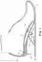 Fig. 02 - Energy return orthotic systems
