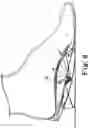 Fig. 07 - Energy return orthotic systems