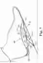 Fig. 08 - Energy return orthotic systems
