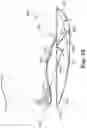 Fig. 22 - Energy return orthotic systems