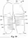 Fig. 41 - Energy return orthotic systems