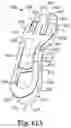 Fig. 44 - Energy return orthotic systems
