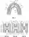 Fig. 02 - Mouthpiece for a dental cleaning device, method of brushing teeth, and dental cleaning device comprising the mouthpiece