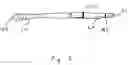 Fig. 06 - Single lumen microcatheter for executing plugs near distal terminus of lumen