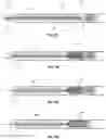 Fig. 07 - Self-rolling apparatuses and methods for removing material from a body lumen