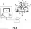 Fig. 02 - Drape management assemblies for robotic surgical systems