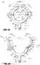 Fig. 04 - Drape management assemblies for robotic surgical systems