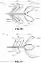 Fig. 10 - Systems and methods for therapeutic nasal neuromodulation