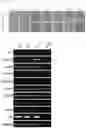 Fig. 02 - Production method for kidney-like tissue