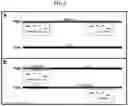 Fig. 02 - Methods for detecting gene dysregulation by intragenic differential expression