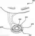 Fig. 01 - Gold electroplating solution and method