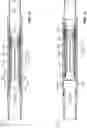 Fig. 07 - Profile-selective sleeves for subsurface multi-stage valve actuation