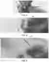 Fig. 03 - METHOD FOR IDENTIFYING EMBEDDED SAMPLES FOR MICROSCOPY