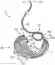 Fig. 01 - Devices, systems, and methods for the treatment of vascular defects