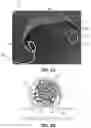 Fig. 08 - Devices, systems, and methods for the treatment of vascular defects