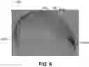 Fig. 15 - Devices, systems, and methods for the treatment of vascular defects