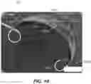 Fig. 16 - Devices, systems, and methods for the treatment of vascular defects