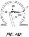 Fig. 24 - Devices, systems, and methods for the treatment of vascular defects