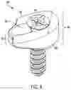 Fig. 07 - Compression force magnifier