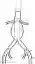 Fig. 01 - Planning support for an interventional procedure