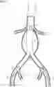 Fig. 02 - Planning support for an interventional procedure