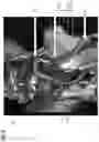 Fig. 05 - Planning support for an interventional procedure