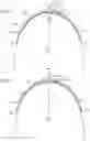 Fig. 03 - Negative pressure wound closure devices and methods