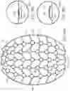 Fig. 36 - Negative pressure wound closure devices and methods