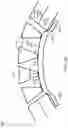 Fig. 38 - Negative pressure wound closure devices and methods