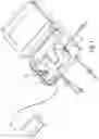 Fig. 08 - Apparatus for performing peritoneal ultrafiltration