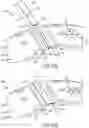 Fig. 05 - Heat shield retainer and method