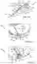Fig. 06 - Heat shield retainer and method