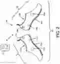 Fig. 03 - POOL CLEANSING SYSTEM AND WEARABLE DEVICES THEREOF