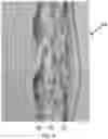 Fig. 07 - Light weight modular pouch attachment system and method
