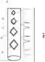 Fig. 05 - Implant with sensor assembly