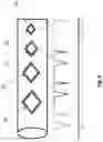 Fig. 07 - Implant with sensor assembly