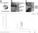Fig. 01 - IMMUNMODULATION FOR PREVENTION OF POOR HEALING OF MUSCULOSKELETAL INJURIES IN COMPROMISED PATIENTS