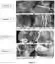 Fig. 07 - Superabsorbent materials and methods of making the same