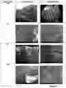 Fig. 11 - Superabsorbent materials and methods of making the same