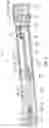 Fig. 03 - Biological fluid separation device