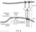 Fig. 05 - CELL COMPRISING A CHIMERIC ANTIGEN RECEPTOR (CAR)